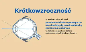 Jaka jest najmniejsza wada wzroku i jak wpływa na codzienne życie
