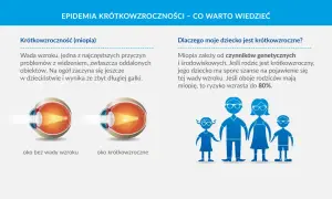 Ilustracja przedstawia przekroje oka zdrowego i krótkowzrocznego oraz sylwetki rodziny.