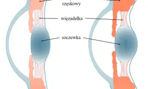 Jak działa soczewka oka i dlaczego ma kluczowe znaczenie dla wzroku