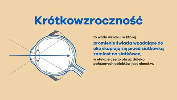 Jaka jest najmniejsza wada wzroku i jak wpływa na codzienne życie